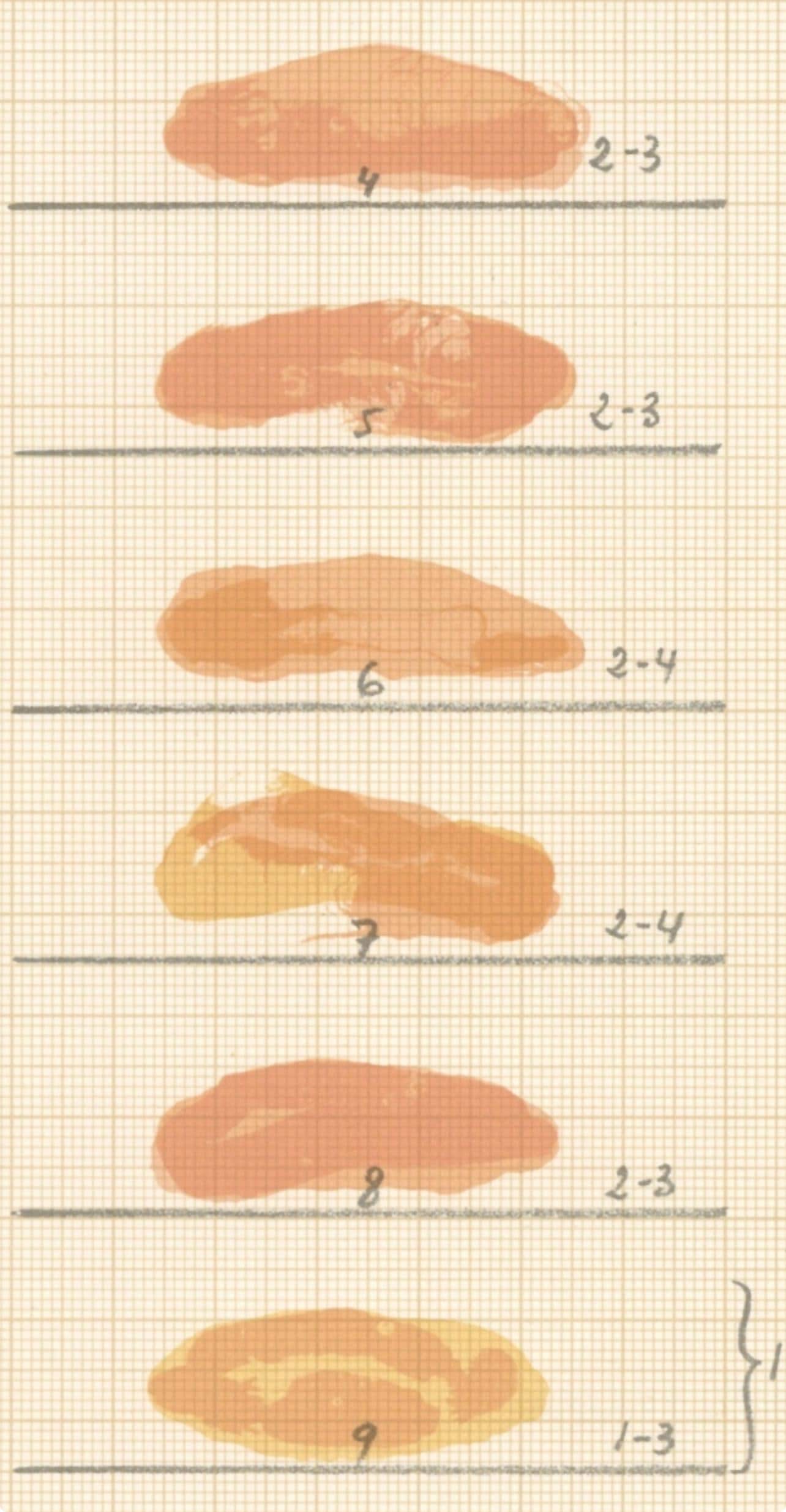 Joan Hernndez-Pijuan, Composition, Ediciones Polgrafa, Redfern Gallery, Lithograph