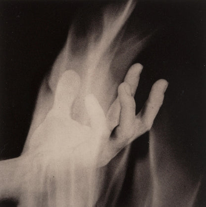 Robert Mapplethorpe, Hand In Fire, A Season In Hell, Photogravure