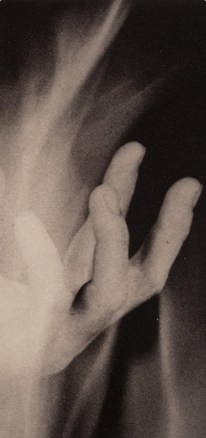 Robert Mapplethorpe, Hand In Fire, A Season In Hell, Photogravure