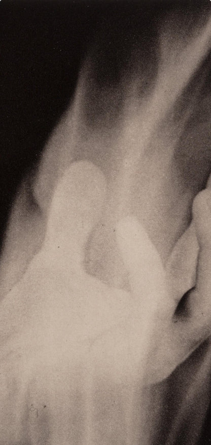 Robert Mapplethorpe, Hand In Fire, A Season In Hell, Photogravure