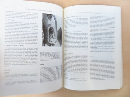 Manuel Du Developpement Psycho-Moteur De L'Enfant 1St 1981 Masson French